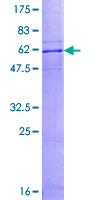 12.5% SDS-PAGE Stained with Coomassie Blue.